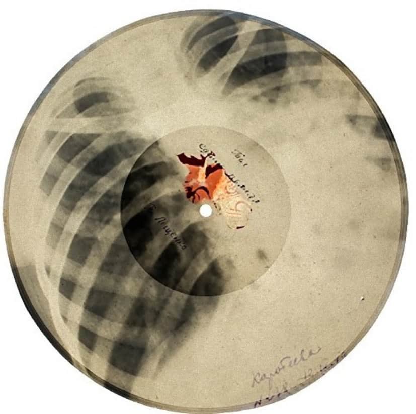 先日、ソ連で「肋骨レコード」と言うレコードが有ったのを知った。1940