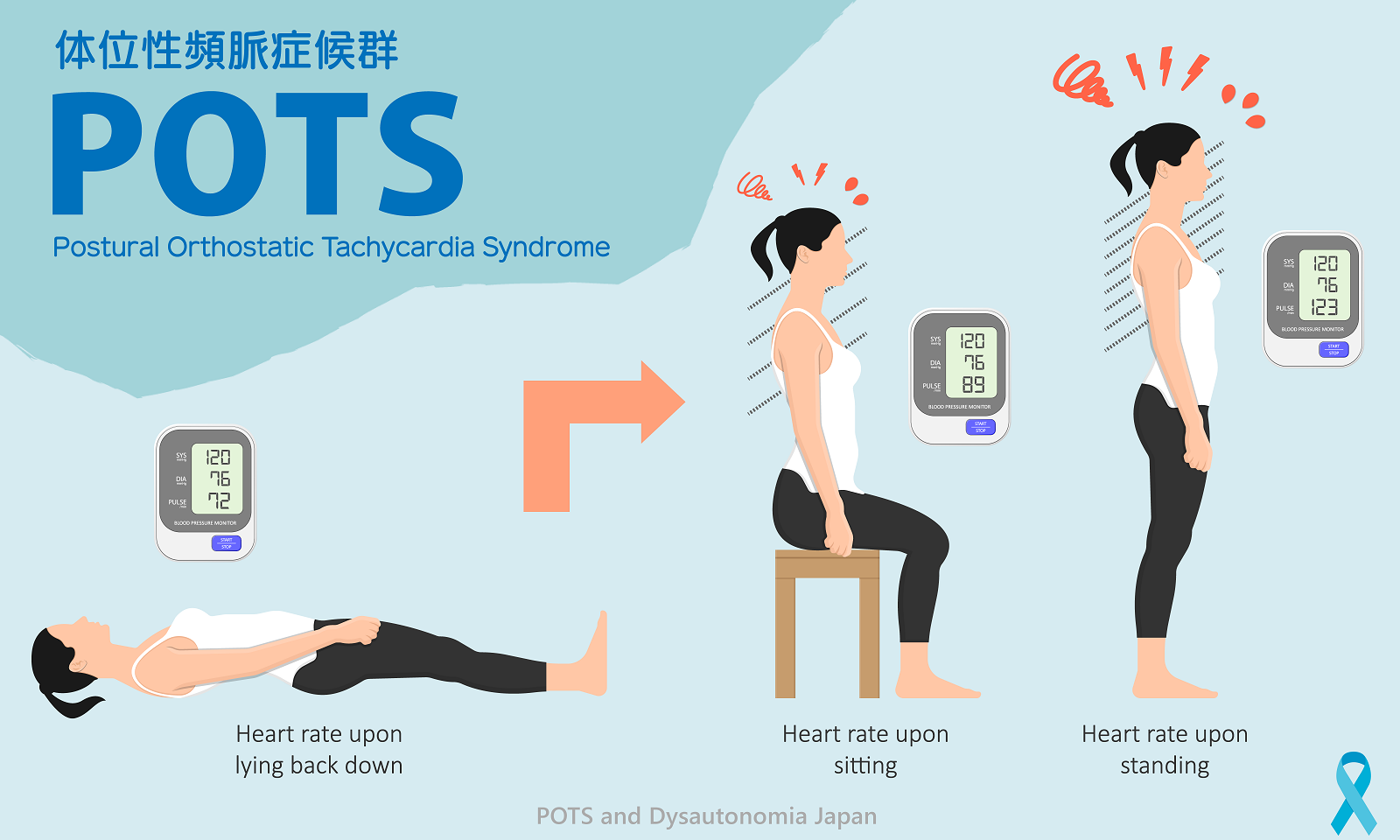 POTSの概要と症状 | POTS and Dysautonomia Japan