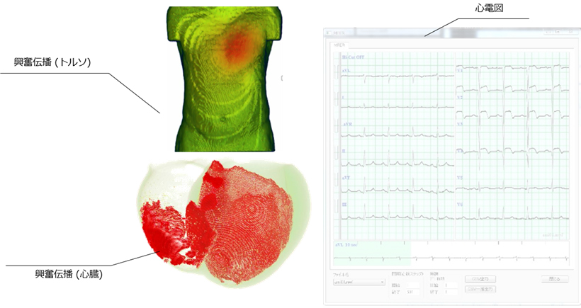 心臓の挙動を学習できる「Heart Explorer」を販売開始 : 富士通