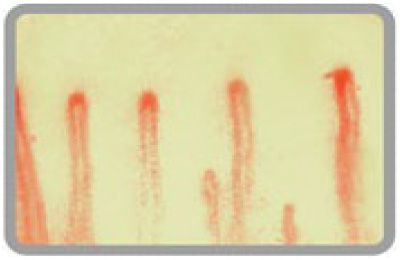 有用な毛細血管観察方法 | NPO法人 QOLサポート研究会