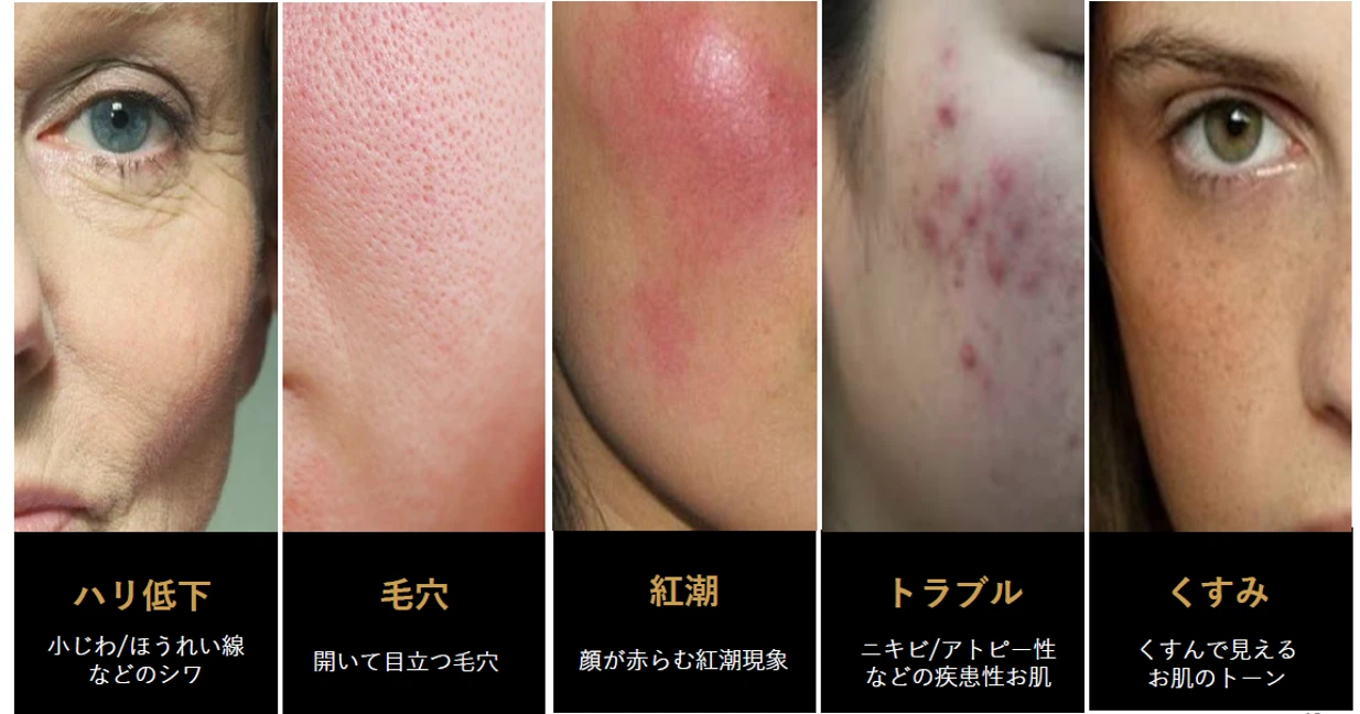 エクソヒーラー（臍帯血幹細胞由来培養上清液） | リアルクリニック