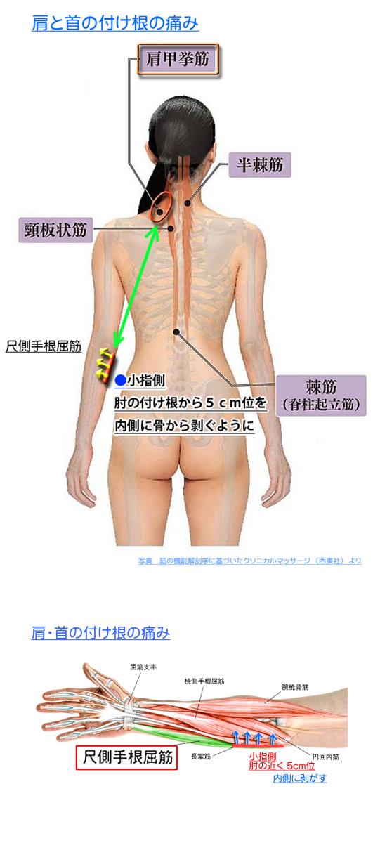 天城流湯治法 肩痛 腕痛 天城流マイスター 小松 隆
