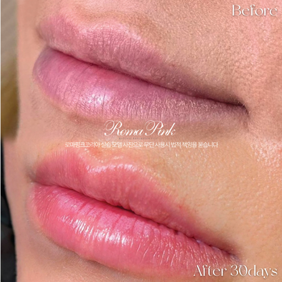 ローマピンク - RP芦屋