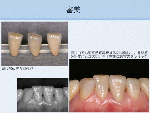 審美修復 | 医療法人 斉田歯科医院：所沢市小手指の歯医者さん