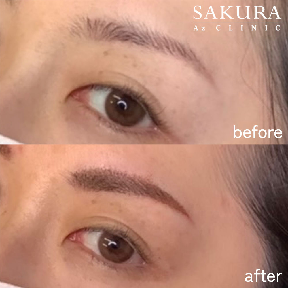 アートメイク | 美容皮膚科・美容外科・婦人科形成 サクラアズ