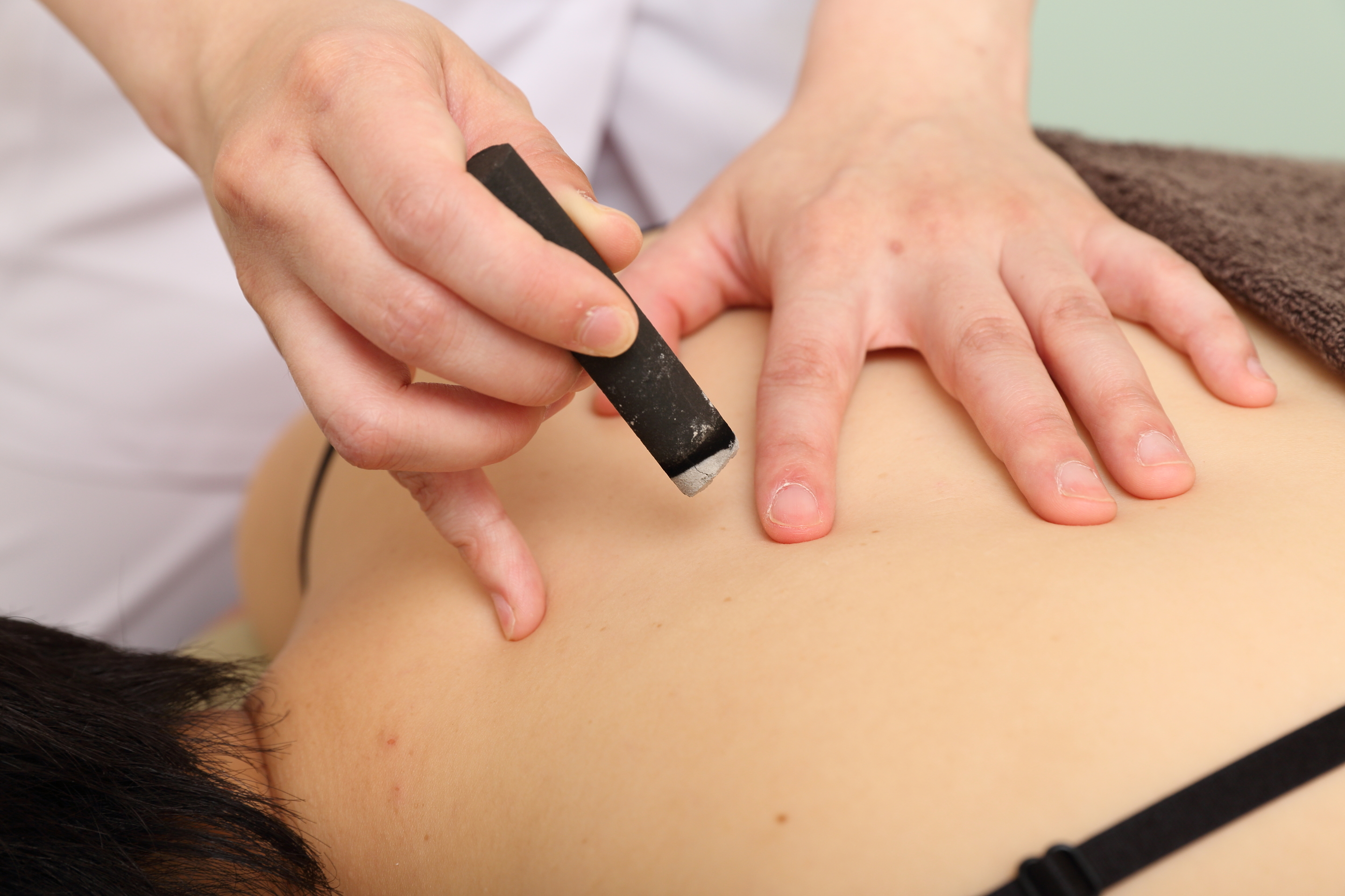 温灸治療☆はり灸治療 | サルビア整骨院 辻堂院