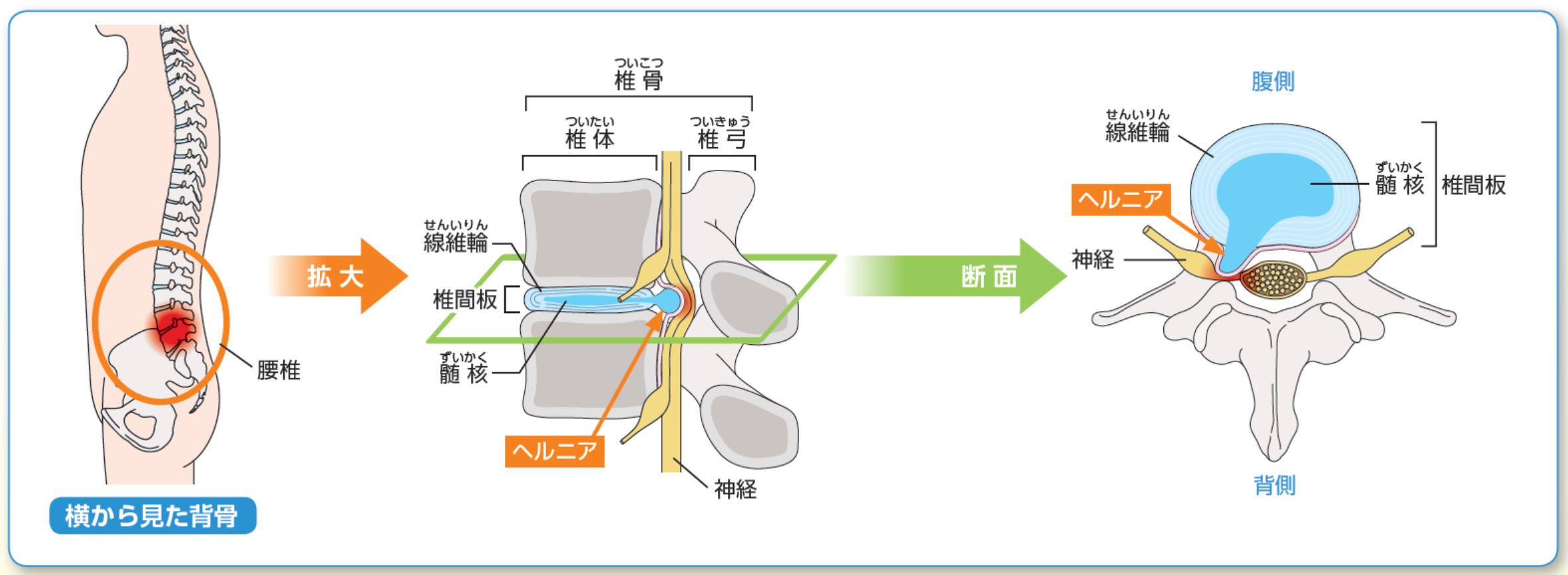 脊椎脊髄外科 | 診療科紹介 | 診療案内 | 社会医療法人孝仁会 札幌孝仁