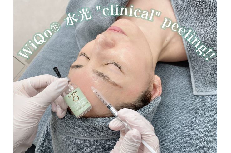 小山市初導入】ワイコ・W水光ピール！マッサージピールのエステ版で艶肌GET