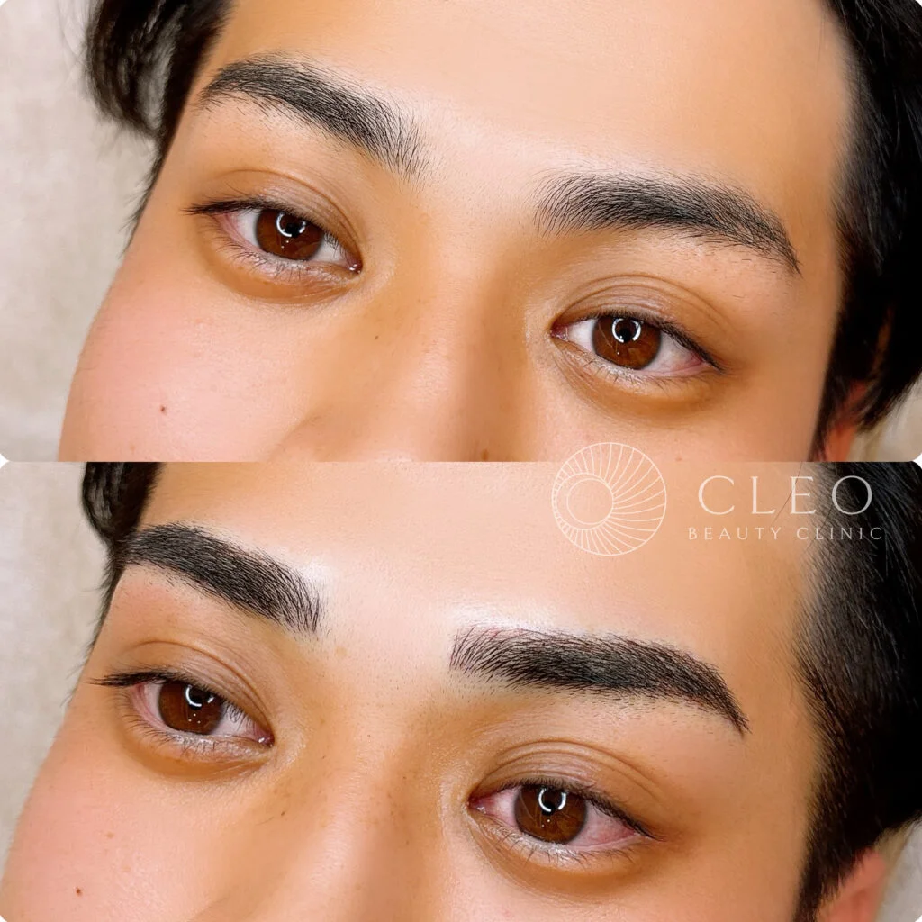 アートメイクモニター募集中 | MEN's CLEO - メンズ美容医療の実績豊富