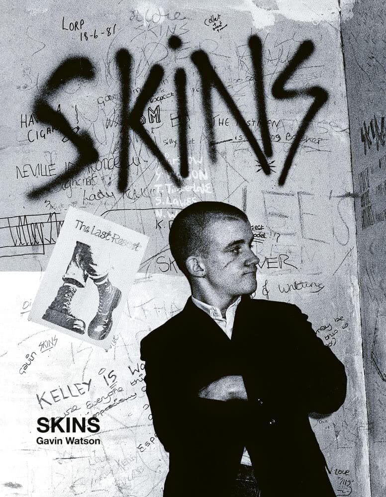 Skins – Heartworm Press