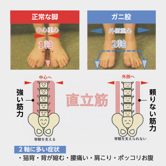 エナジーラバー メディカルホールドGBスポーツ ER-M02GB 足用