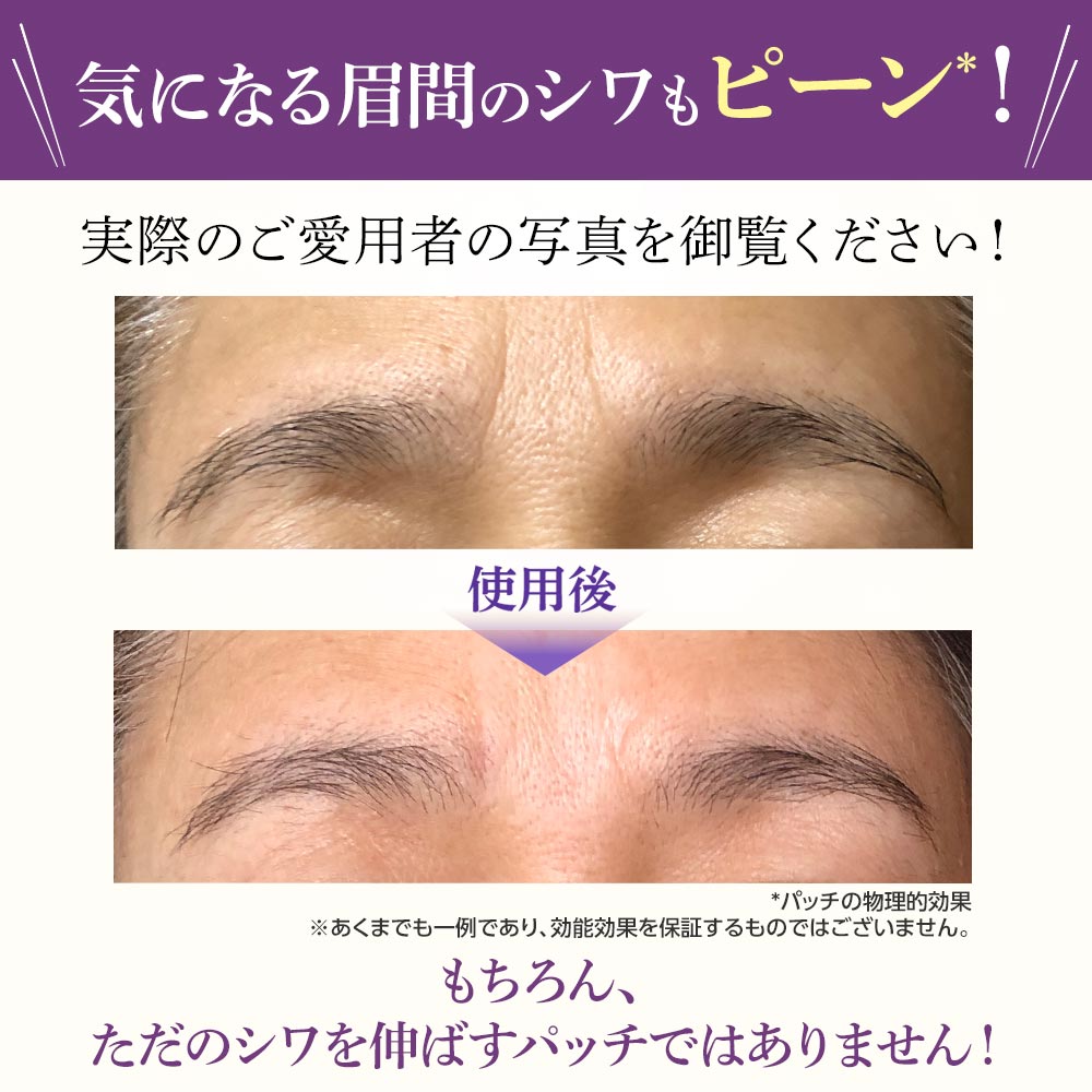 北の快適工房 【爆買WEEKセール!】眉間のシワ 対策 ミケンディープ