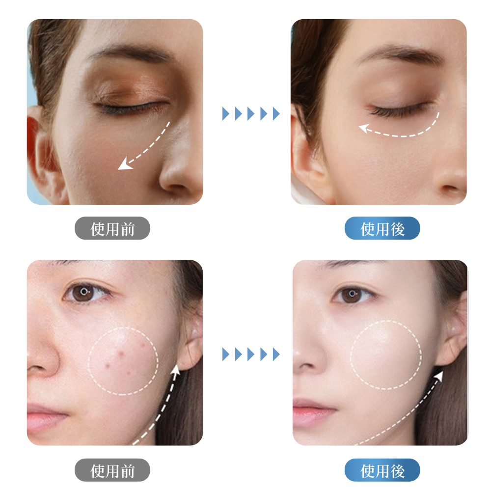 ラッピング対応】 美顔器 イオン導入美顔器 超音波美顔器 光エステ 6