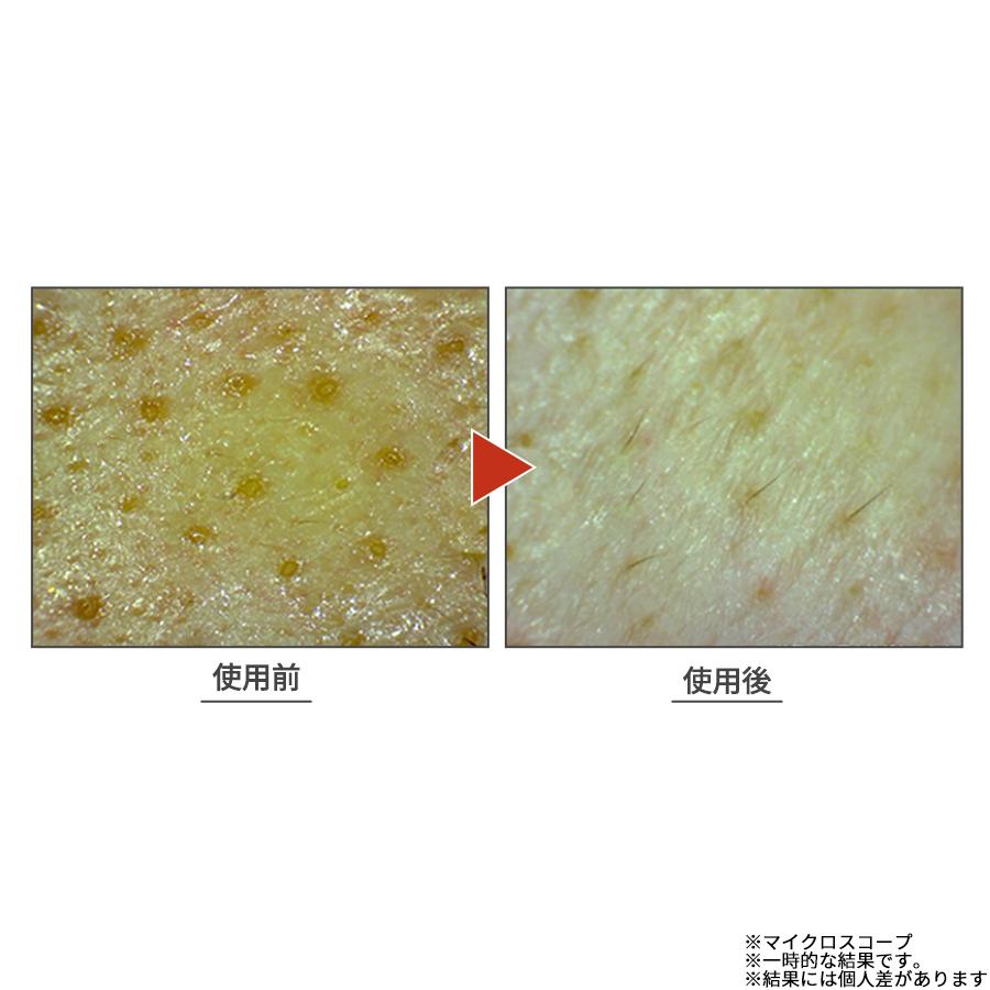 DUO ザ クレンジングバーム 特別セット / デュオ クレンジング 炭 洗顔