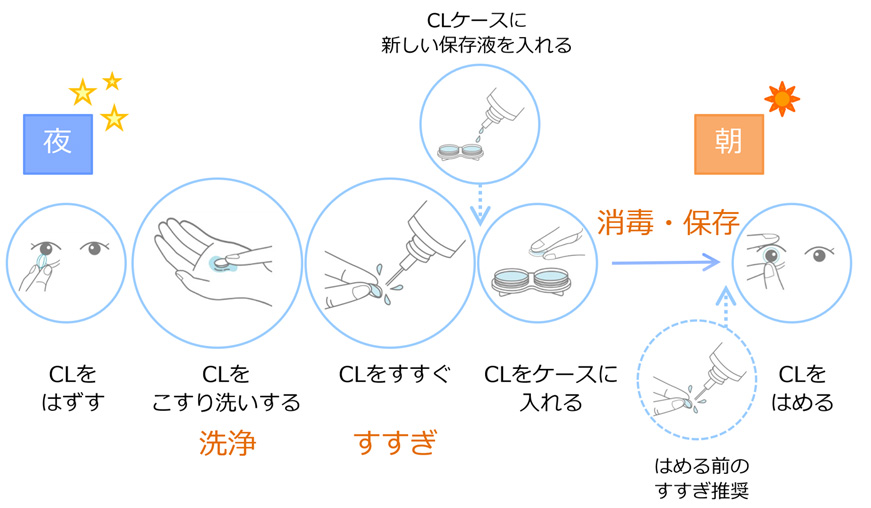 一般向け】レンズケア｜コンタクトレンズと感染症｜SOS-J -日本