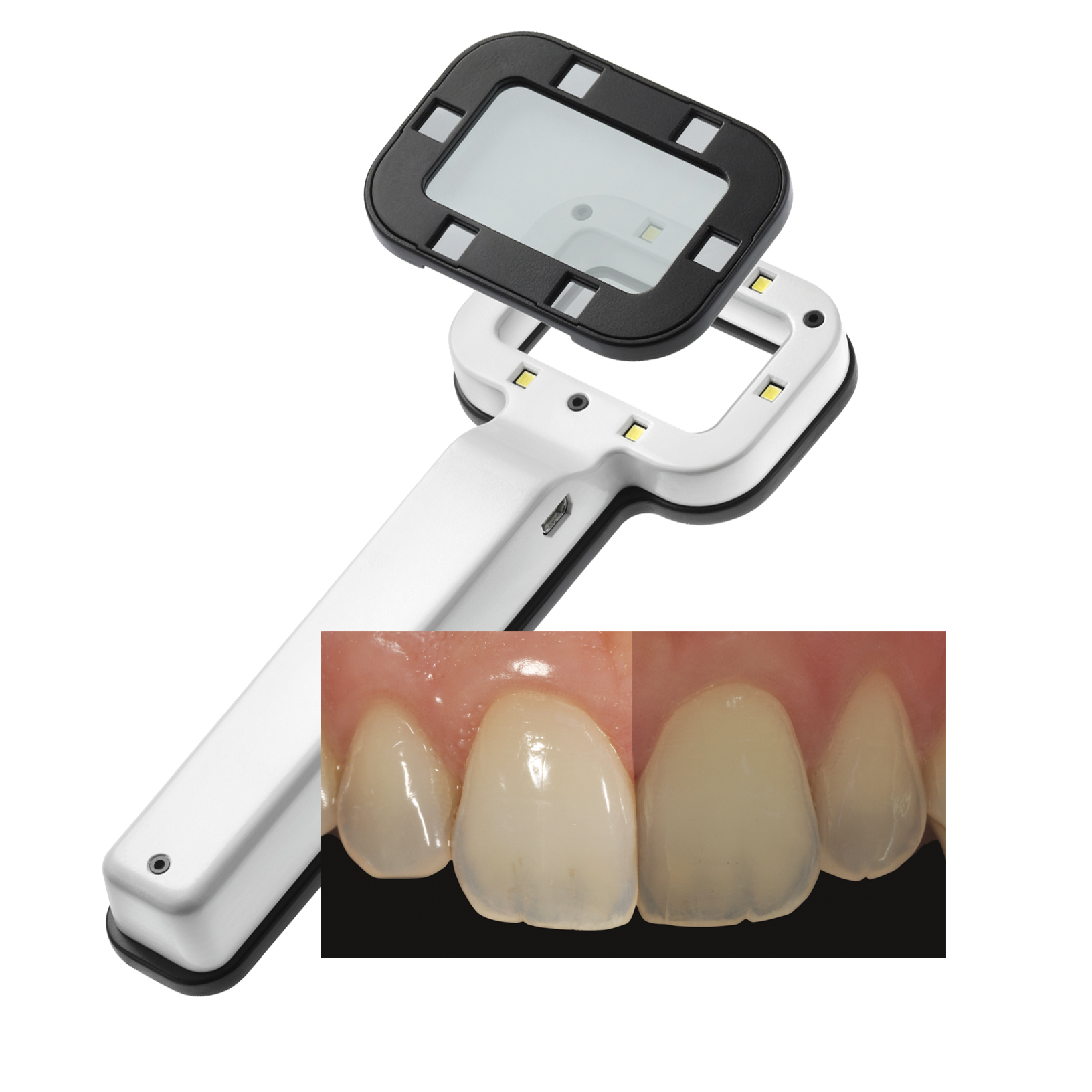 Smile Lite – #6500