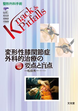 変形性膝関節症 外科的治療の要点と盲点 | 株式会社文光堂