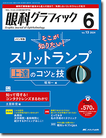 眼科スゴ技 眼瞼手術 | オンラインストア｜看護・医学新刊・セミナー