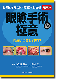 動画＆イラスト＆写真でわかる眼瞼手術の極意 | オンラインストア
