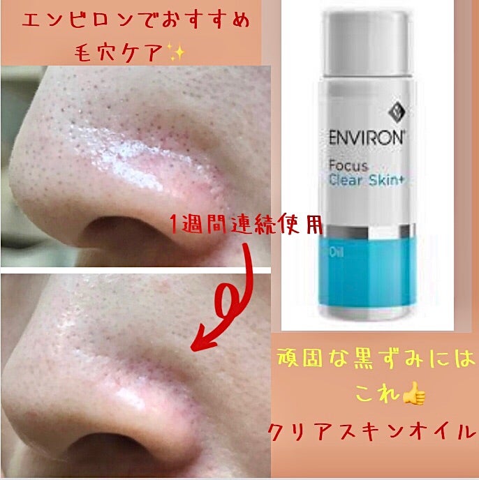 エンビロンで毛穴ケアならクリアスキンオイルもおすすめ☆ | 大阪府