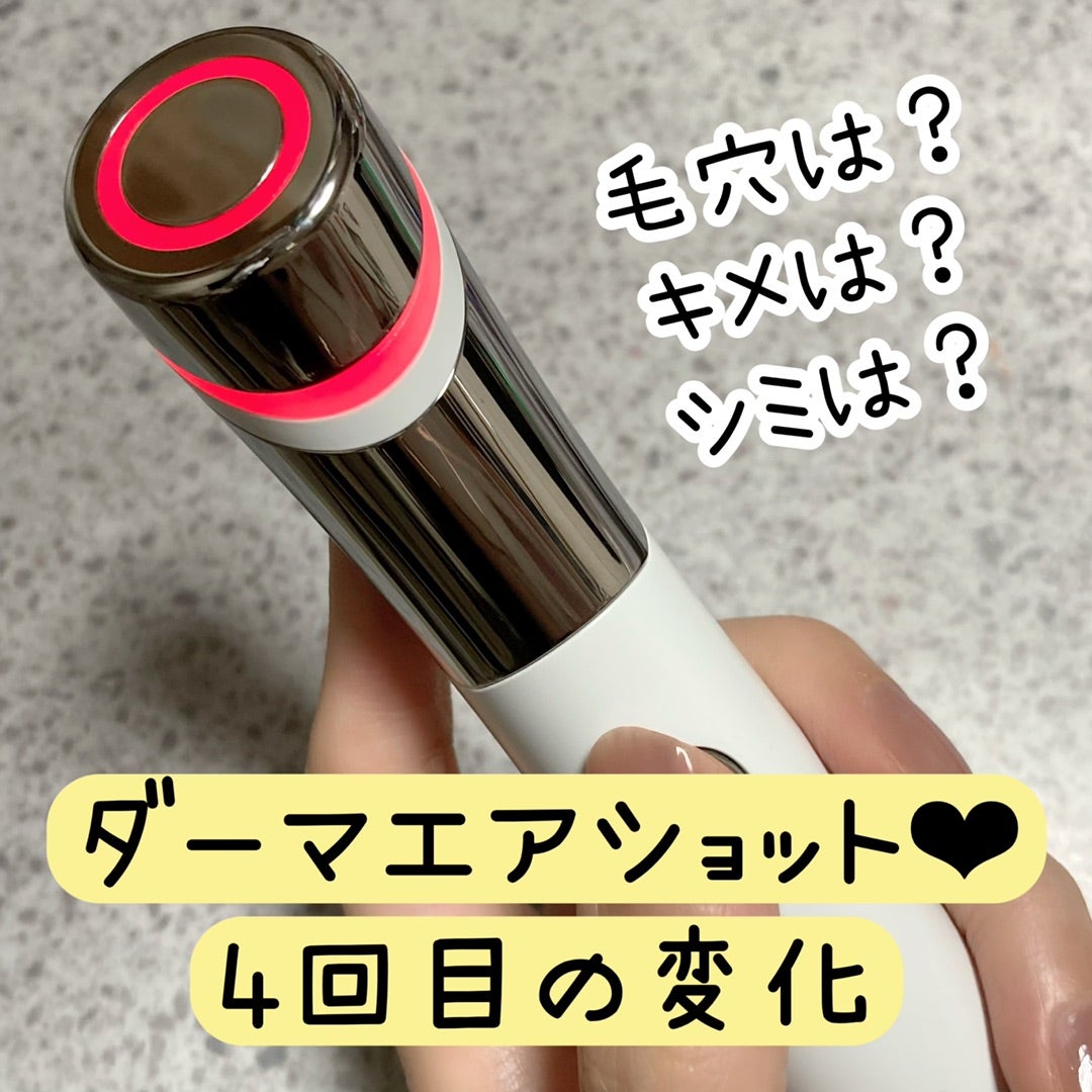 体験談②】ダーマエアショット4回目までの効果レビュー☆電気針
