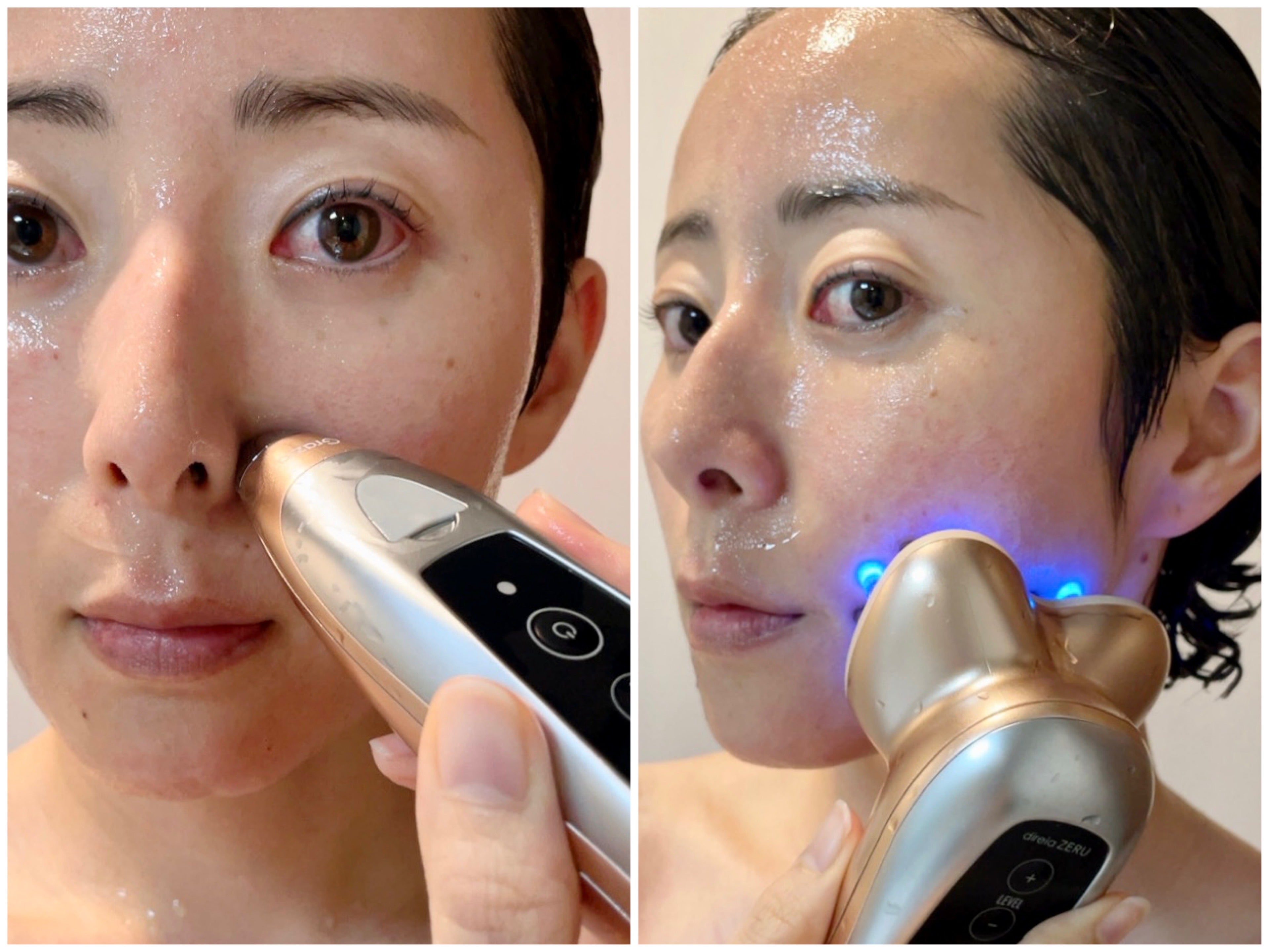 人生“最高級”EMS美顔器ディレイア ゼル！毛穴・美肌・頭皮・全身に