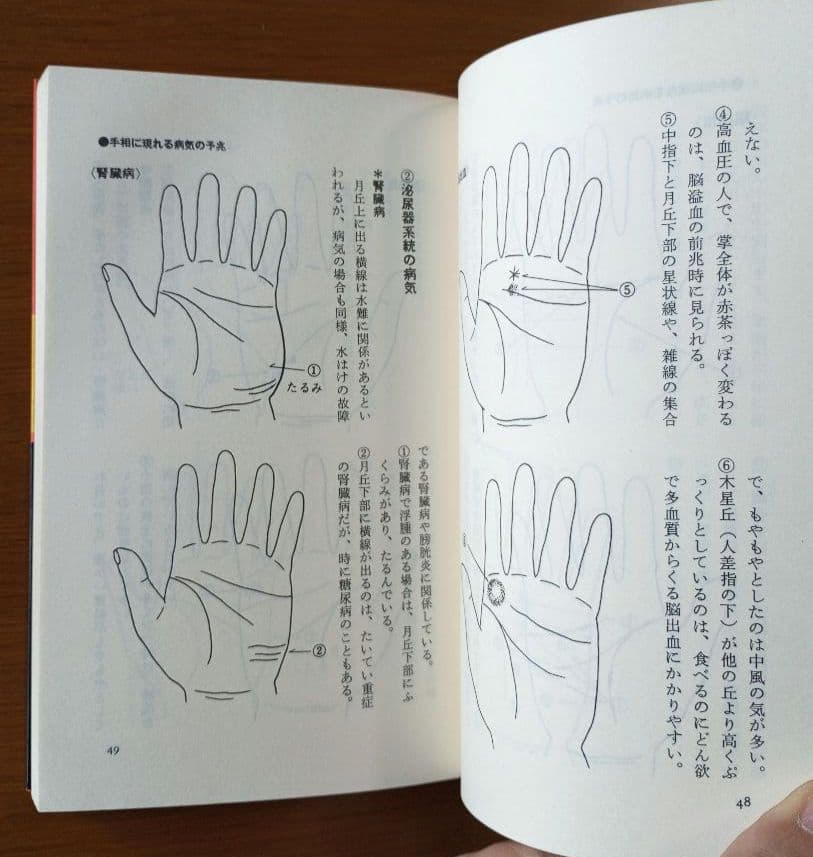手相で病気を早期発見―患者の手形で実証した - restru.cloud