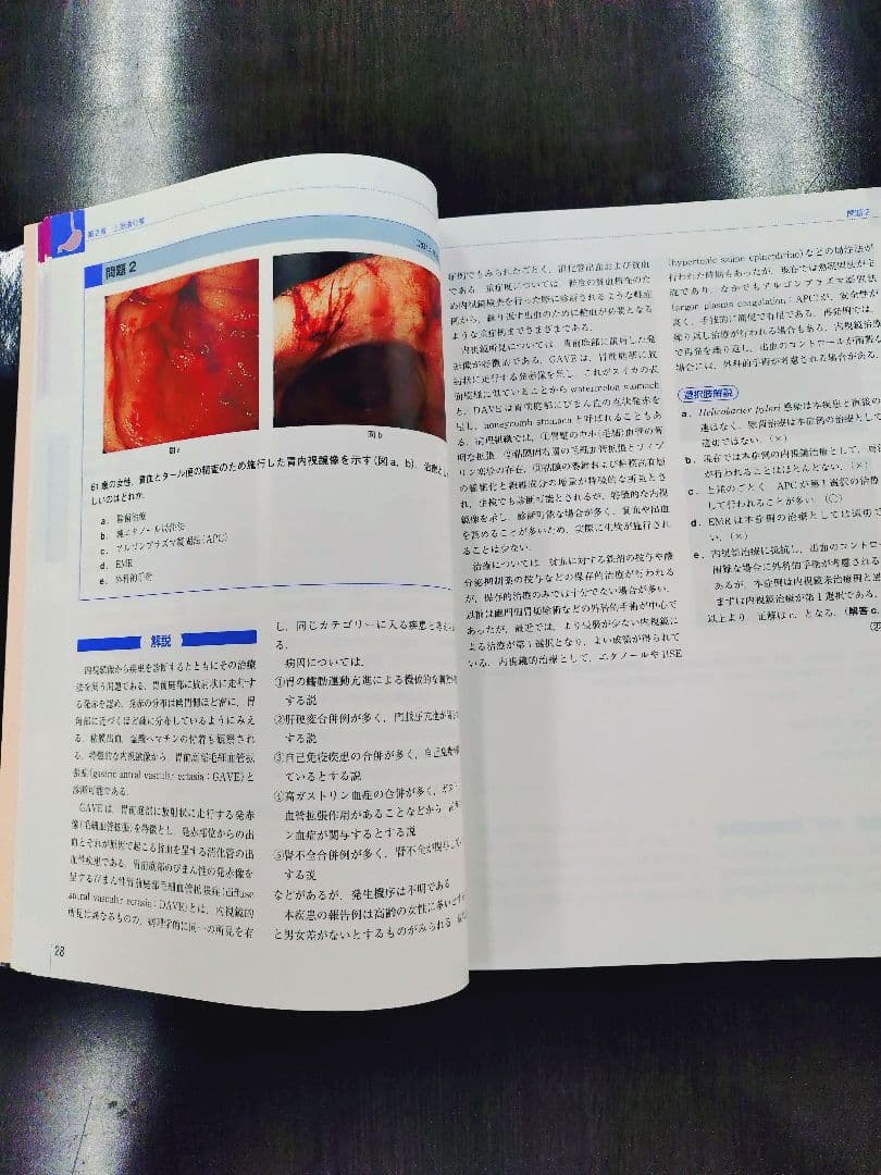日本消化器内視鏡学会 専門医 学術試験問題〈解答と解説〉第5