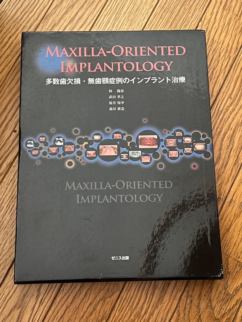 多数歯欠損・無歯顎症例のインプラント治療 Maxilla-Oriented Implantology 多数歯欠損・無歯顎症例への