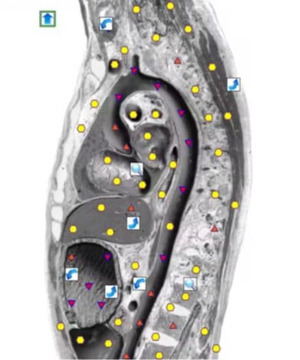 期間限定セール☆波動測定器18D NLS メタトロン ニュースキャン
