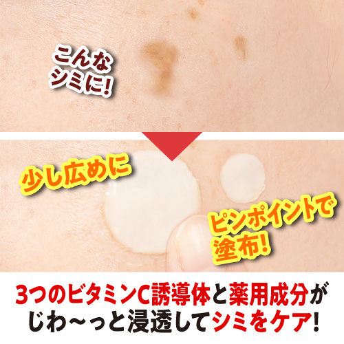 53％OFF】1塗り10分でシミや黒ズミを集中美白！≪薬用美白ピール